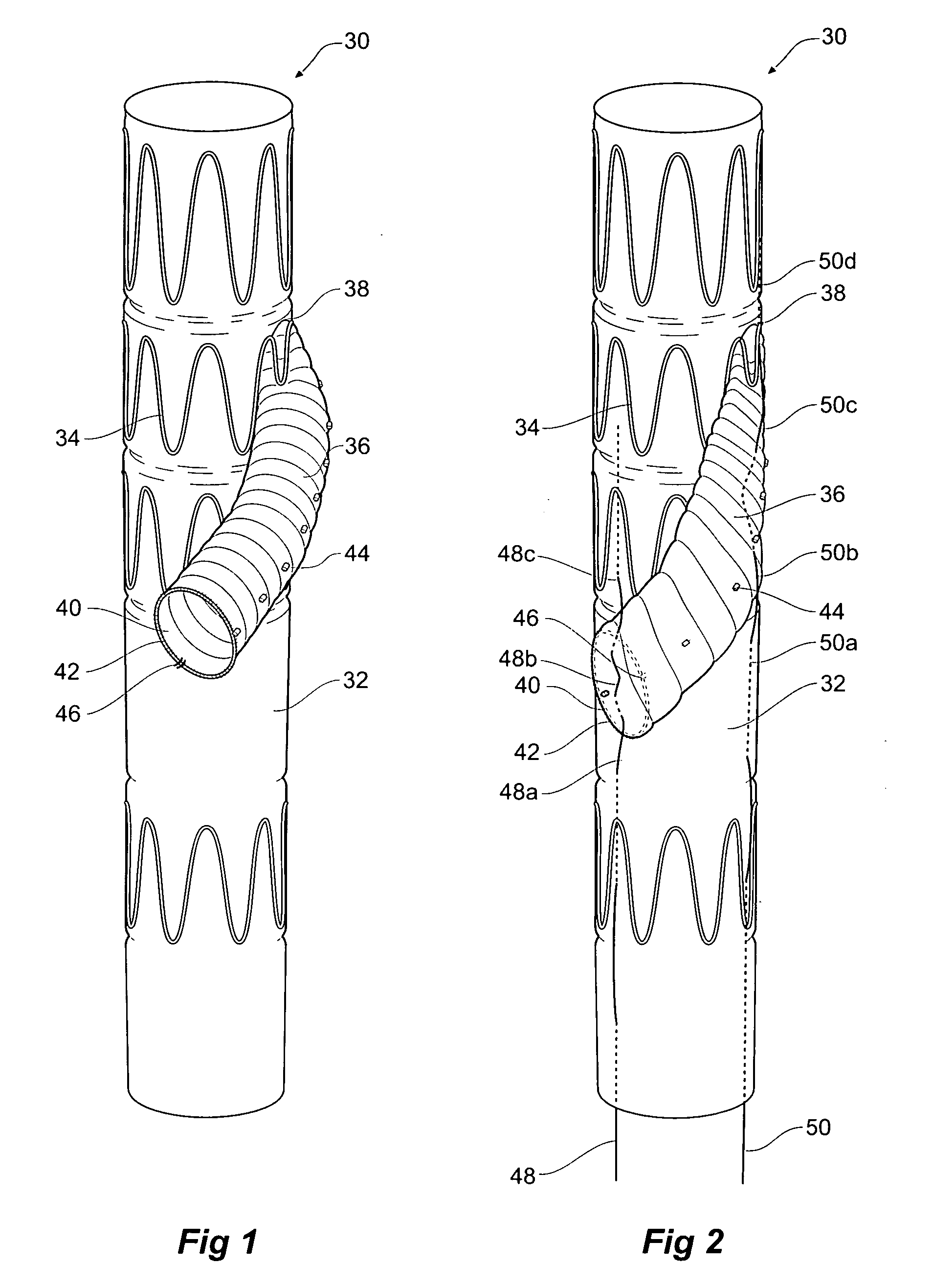 Helical arm tie down