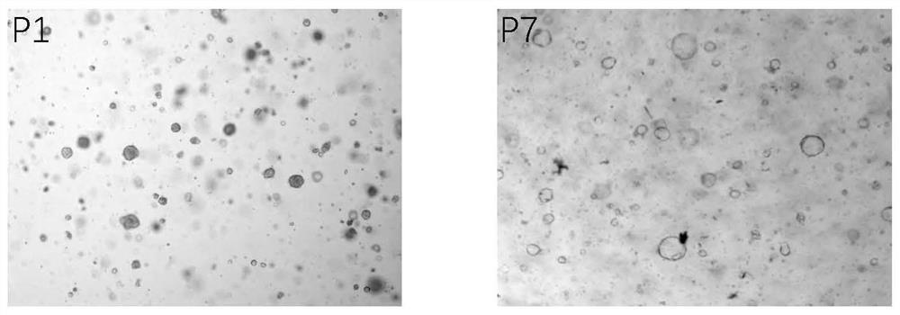 Continuous culture method and culture medium for primary hepatocellular carcinoma organoids