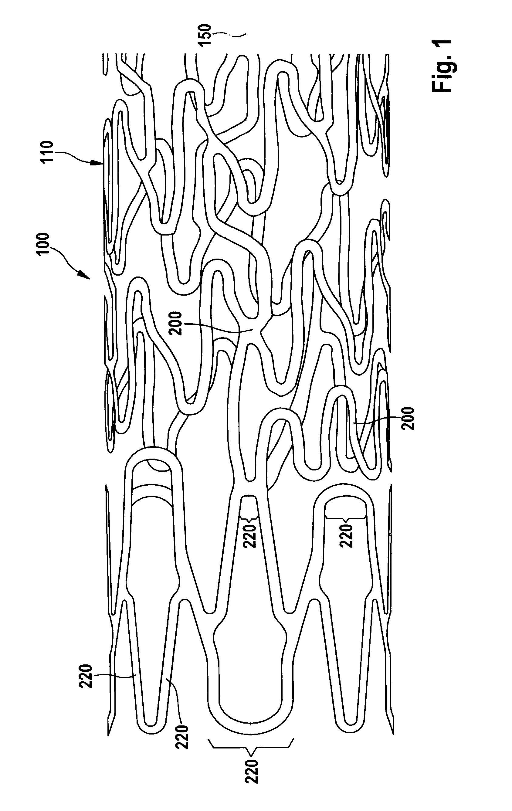 Stent and Method and Device for Fabricating the Stent