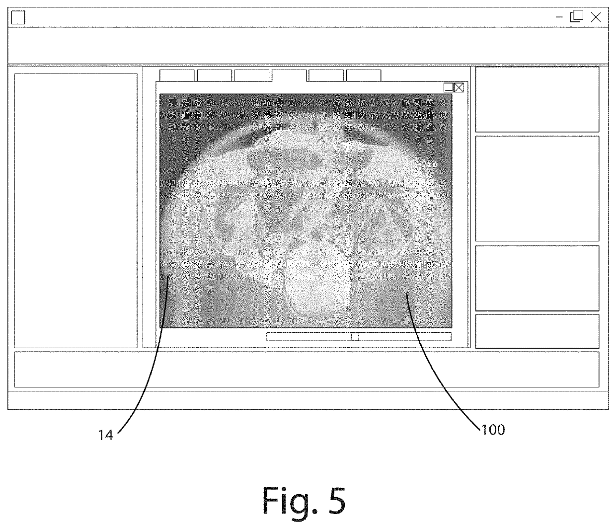 Magnetic resonance imaging patient temperature monitoring system and related methods