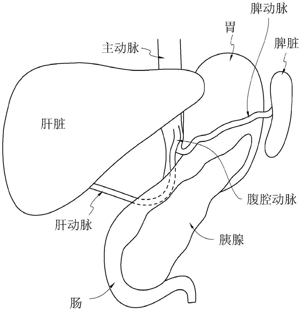 Therapeutic tissue conditioning devices and methods