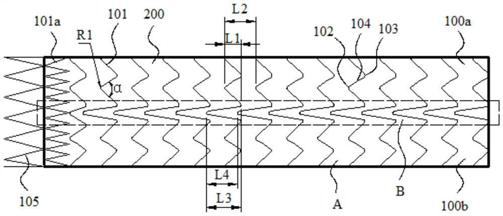 stent graft