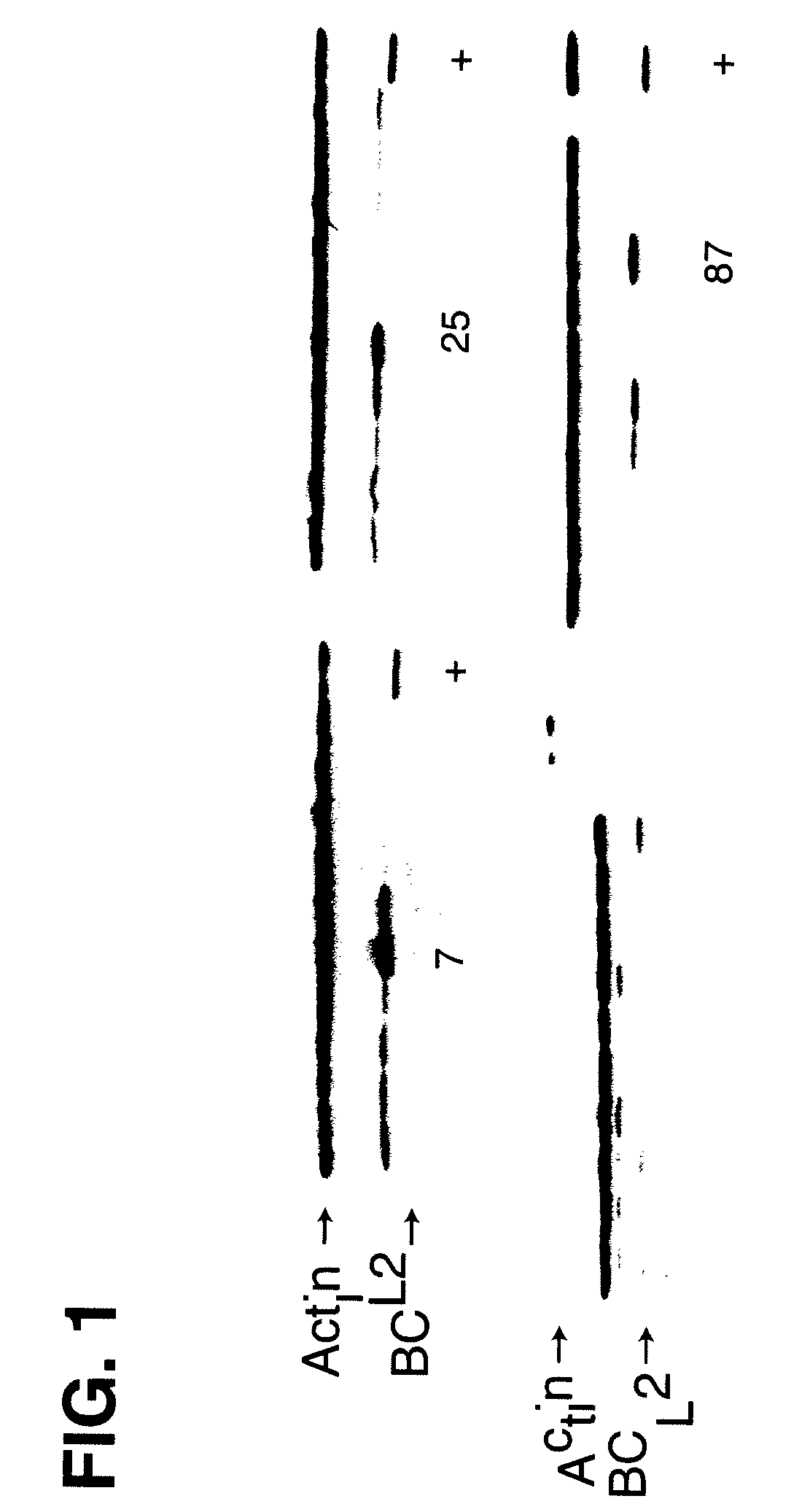 Methods for protein expression in mammalian cells in serum-free medium