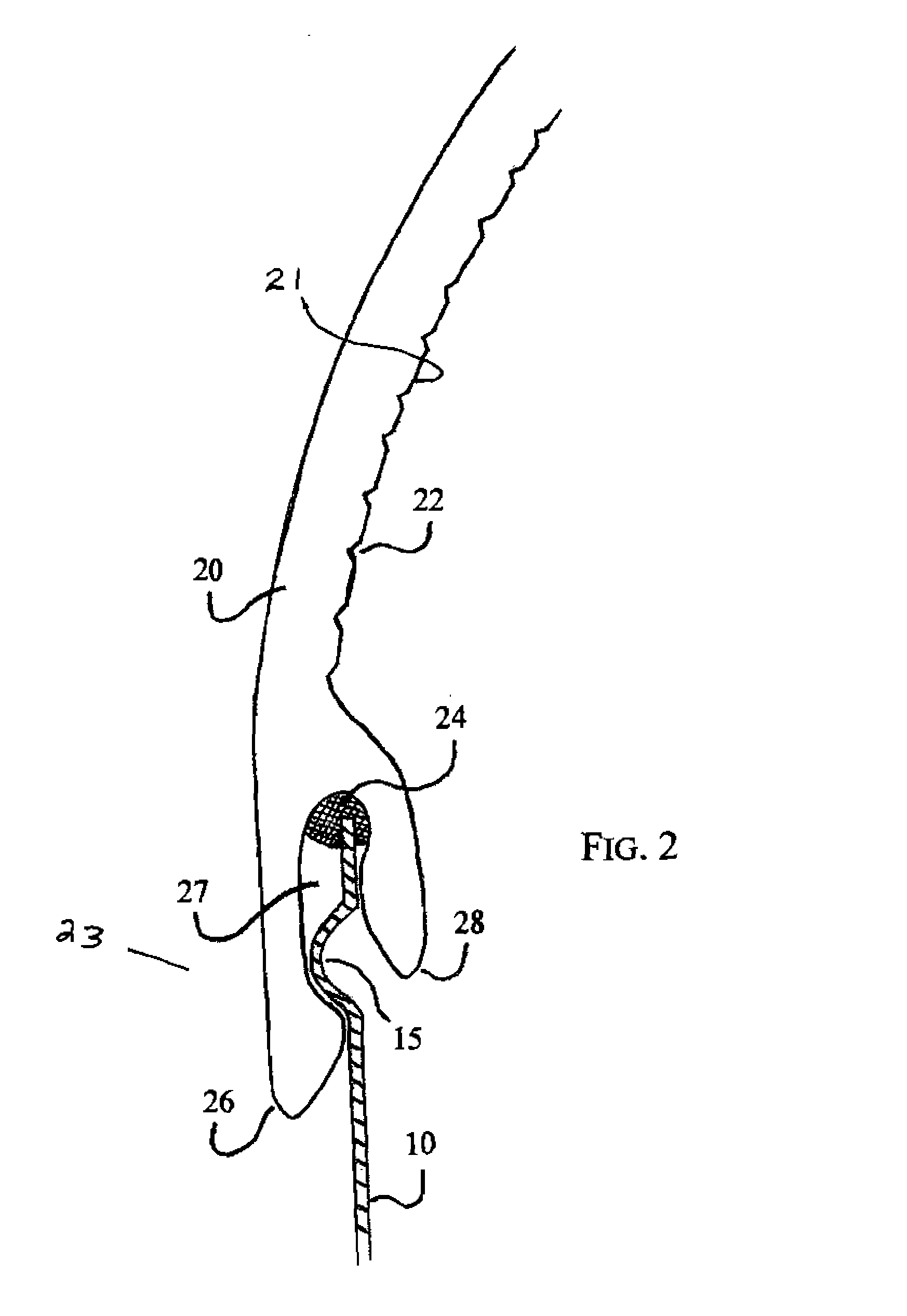 Skylight system