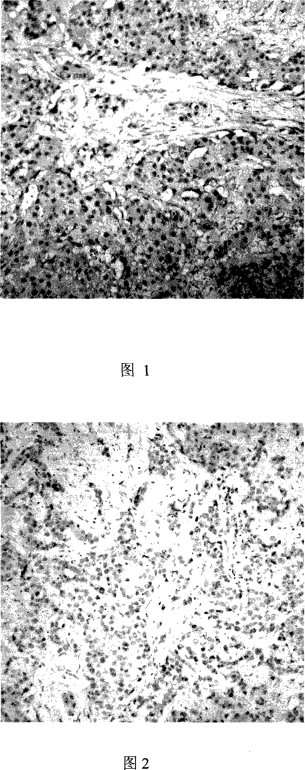 Preparation method of polyase marker antibody