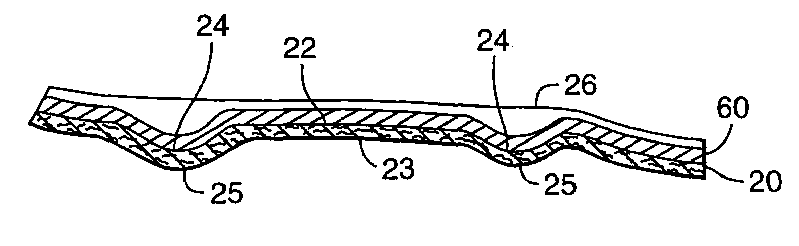 Curable off-loading footwear and methods