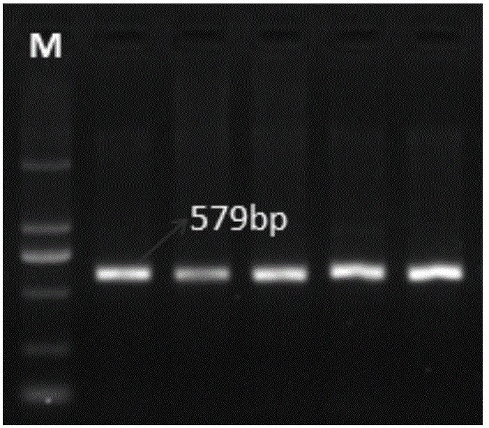 Molecular marker of loin-eye area character-related gene SVEP1 and application of molecular marker