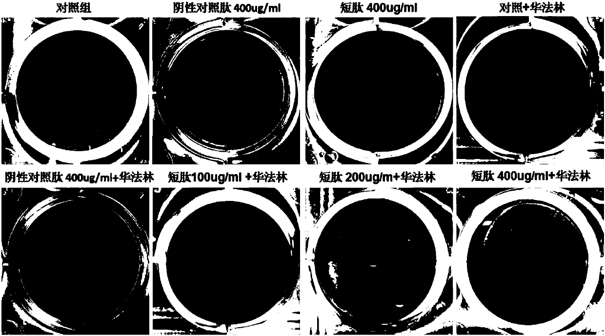 Anti-calcification oligopeptide and application thereof