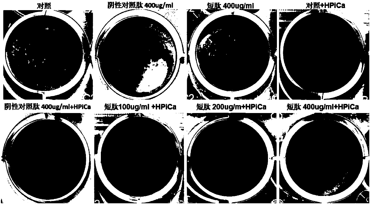 Anti-calcification oligopeptide and application thereof