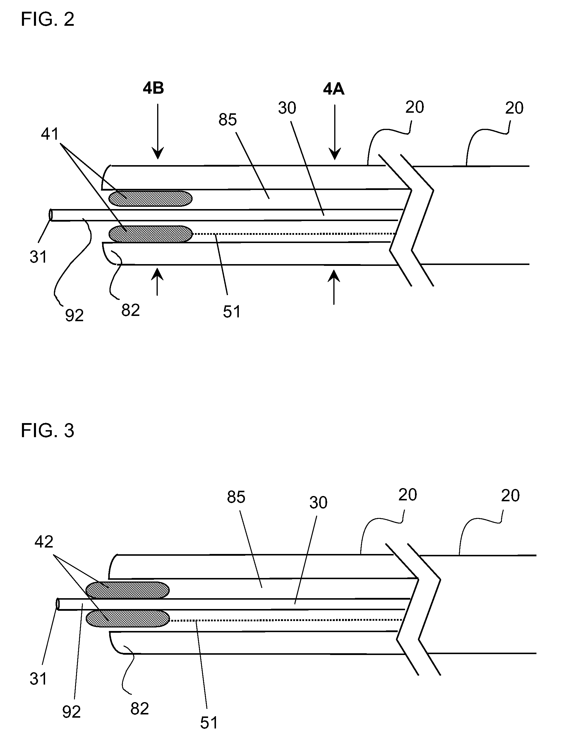 Apparatus and Method for Guided Chronic Total Occlusion Penetration