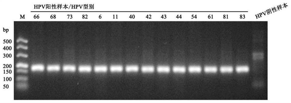 Primer and typing probe combination for detecting human papilloma virus and application of primer and typing probe combination