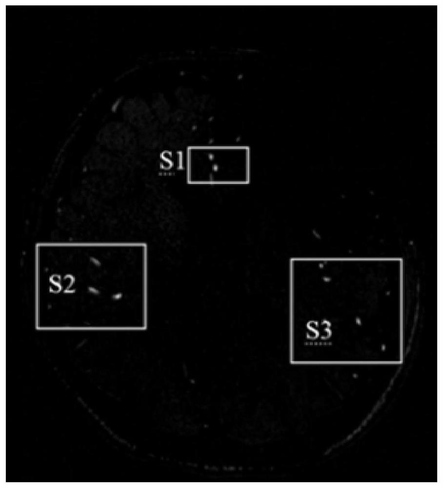 Medical perfusion image processing method and medical imaging equipment