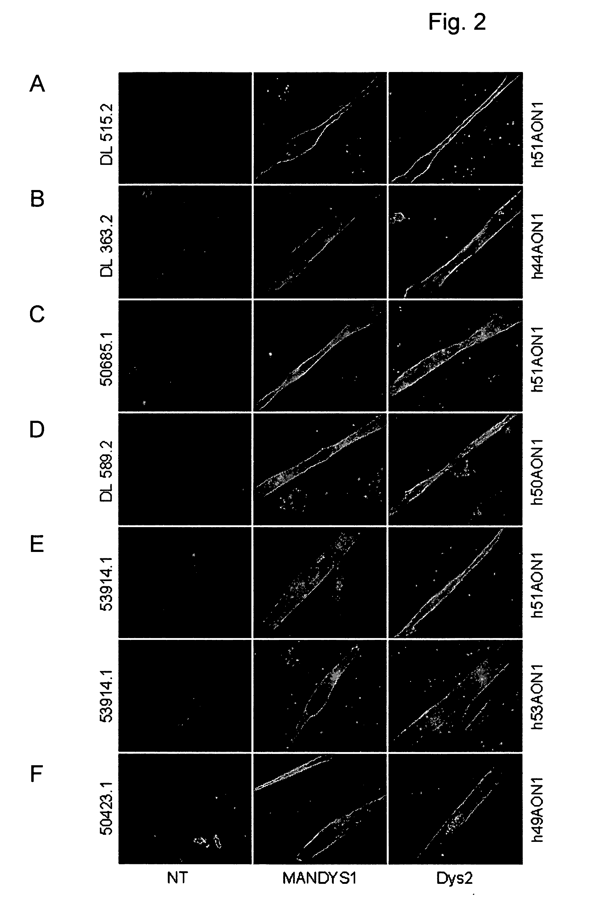 Modulation of exon recognition in pre-mRNA by interfering with the secondary RNA structure