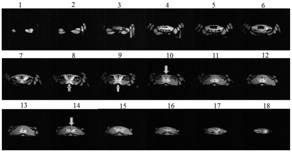 Lossless detection method for fat volume of hepatopancreas and gonad of Eriocheir sinensis