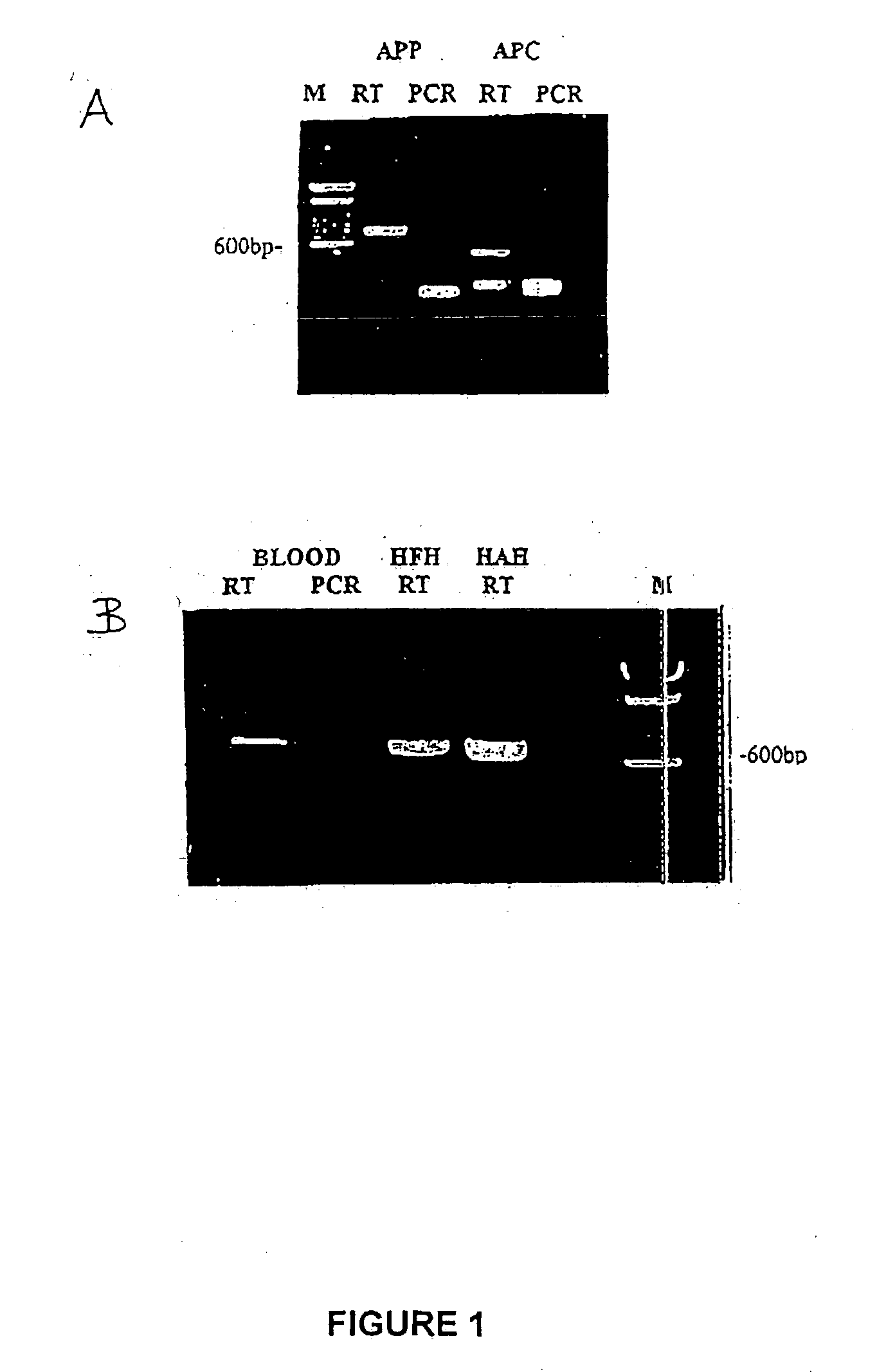 Method for the detection of gene transcripts in blood and uses thereof