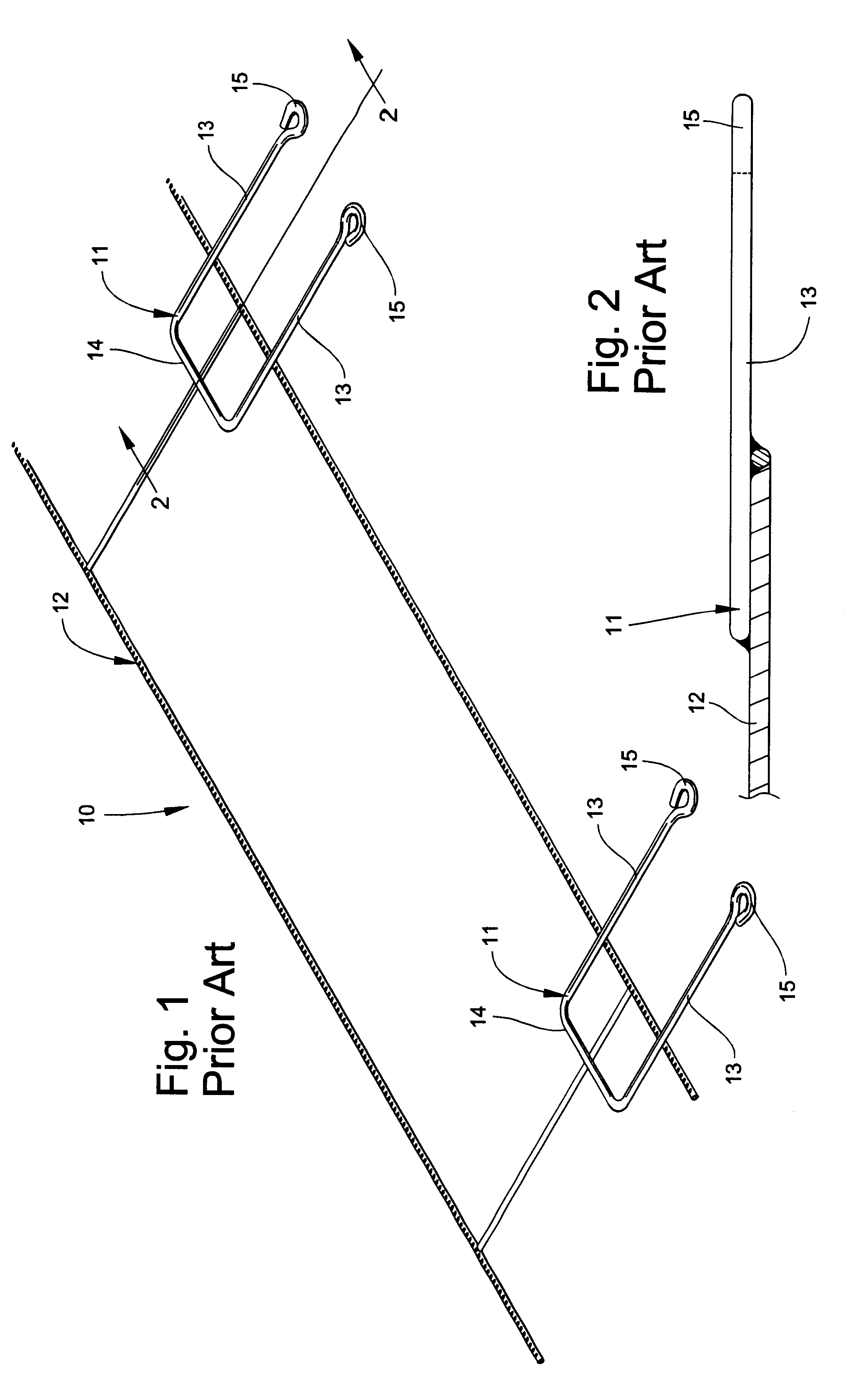 Masonry anchoring system