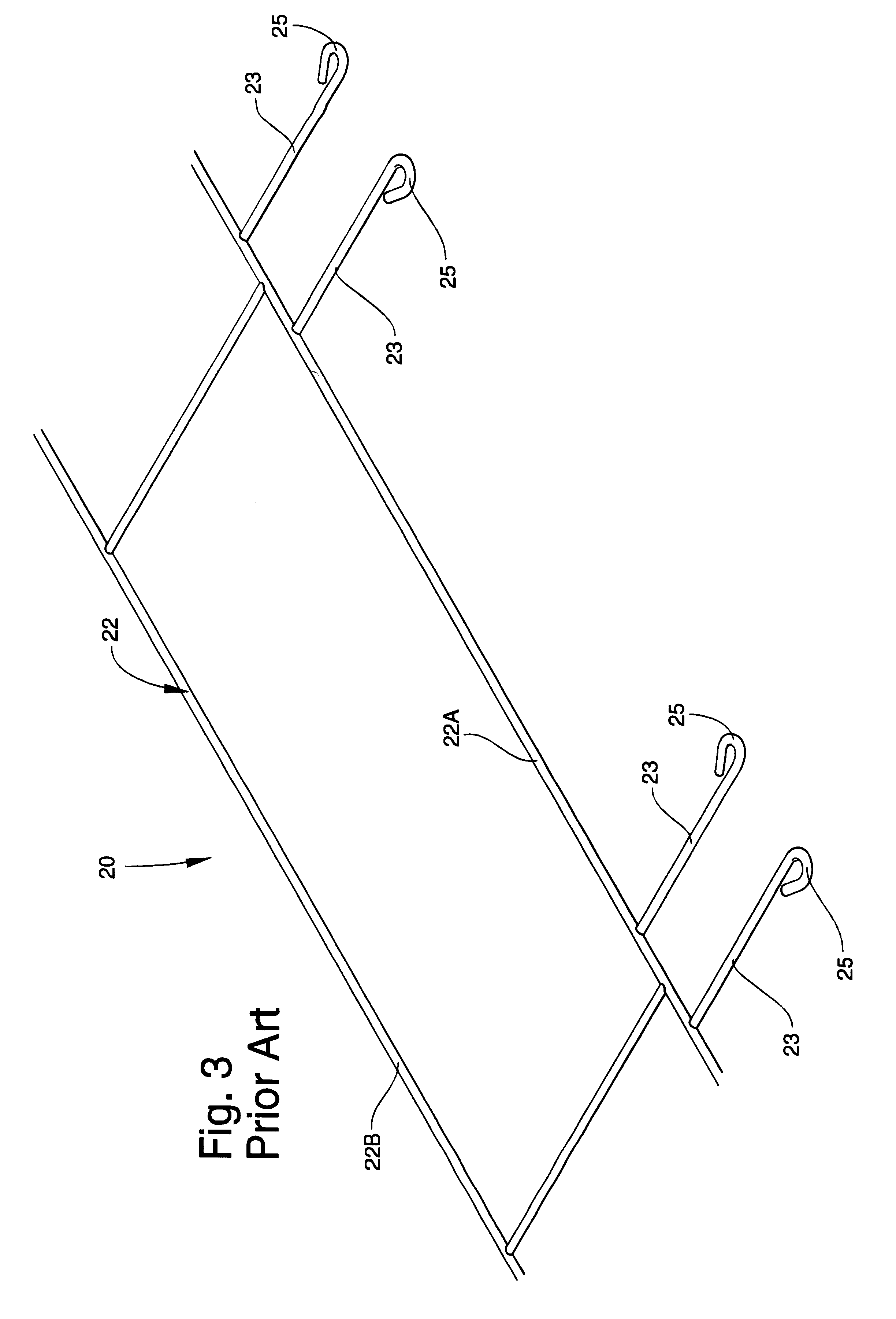 Masonry anchoring system