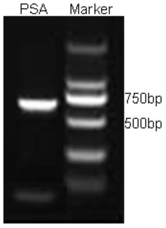 Plasmid expressed by PSA promoter mediated firefly luciferase gene