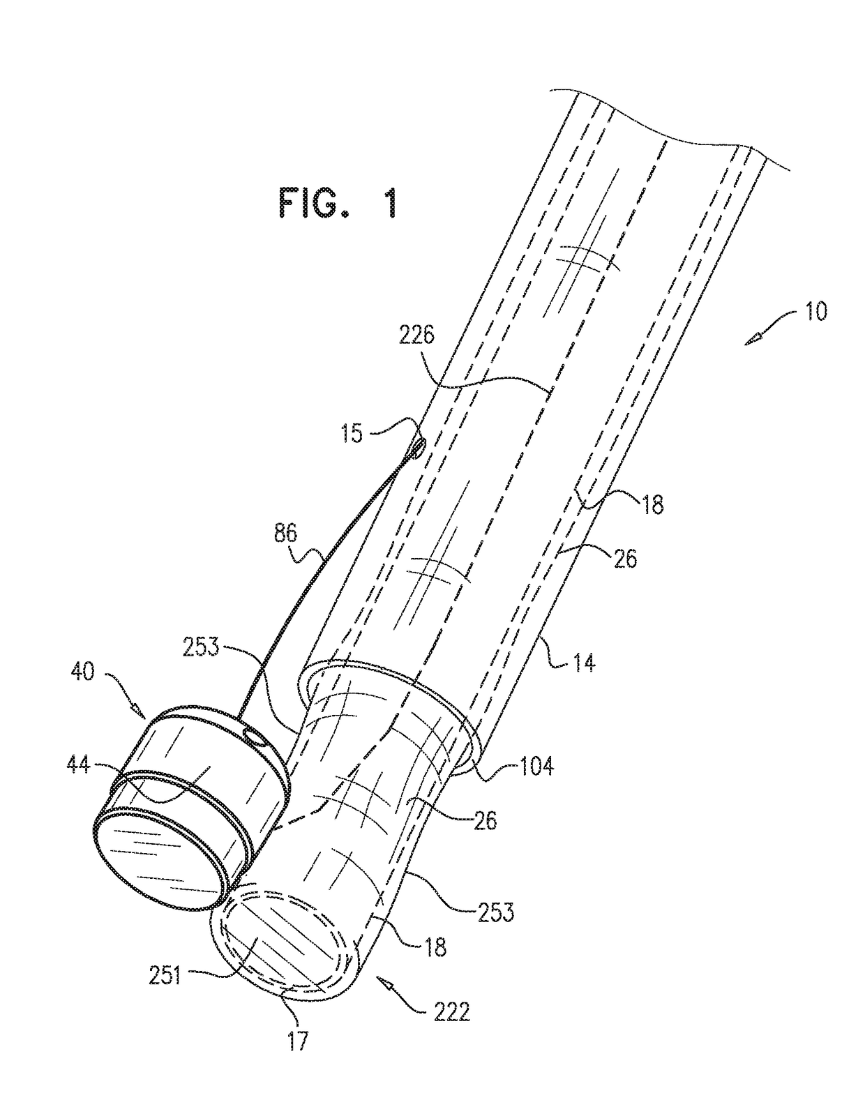 Annuloplasty technologies