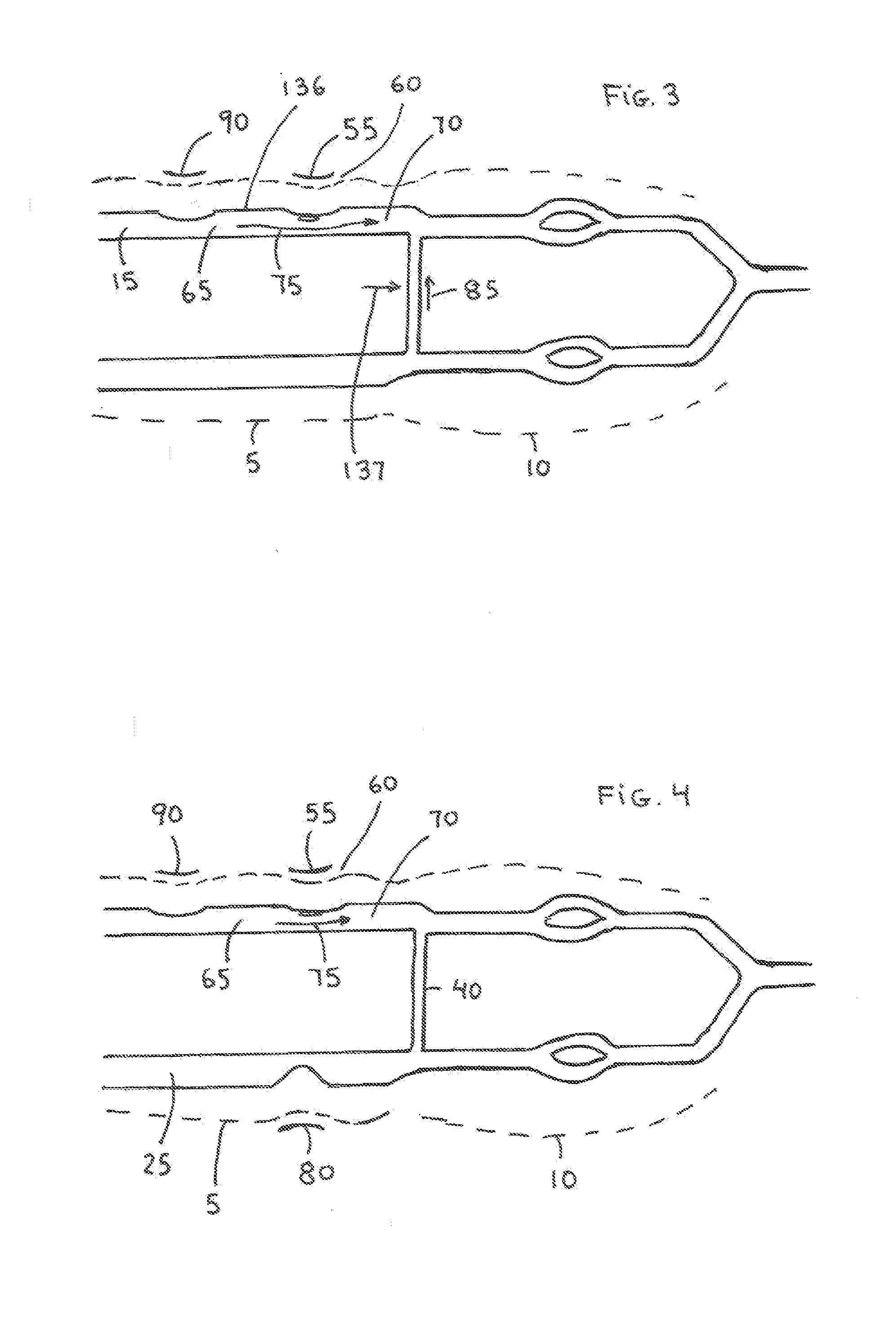 Radial Artery Closure Device