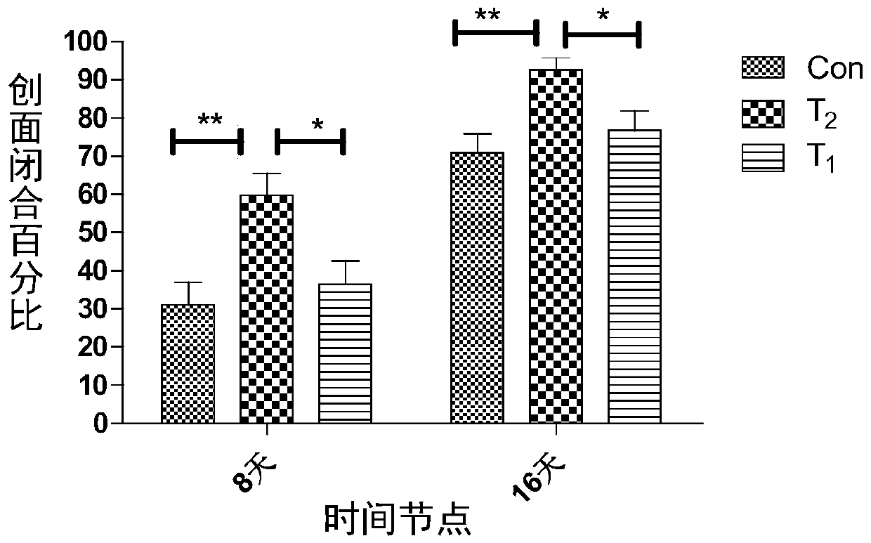 Sodium alginate-chitosan dressing loaded with tetrahydrocurcumin nanoparticles and preparation method thereof