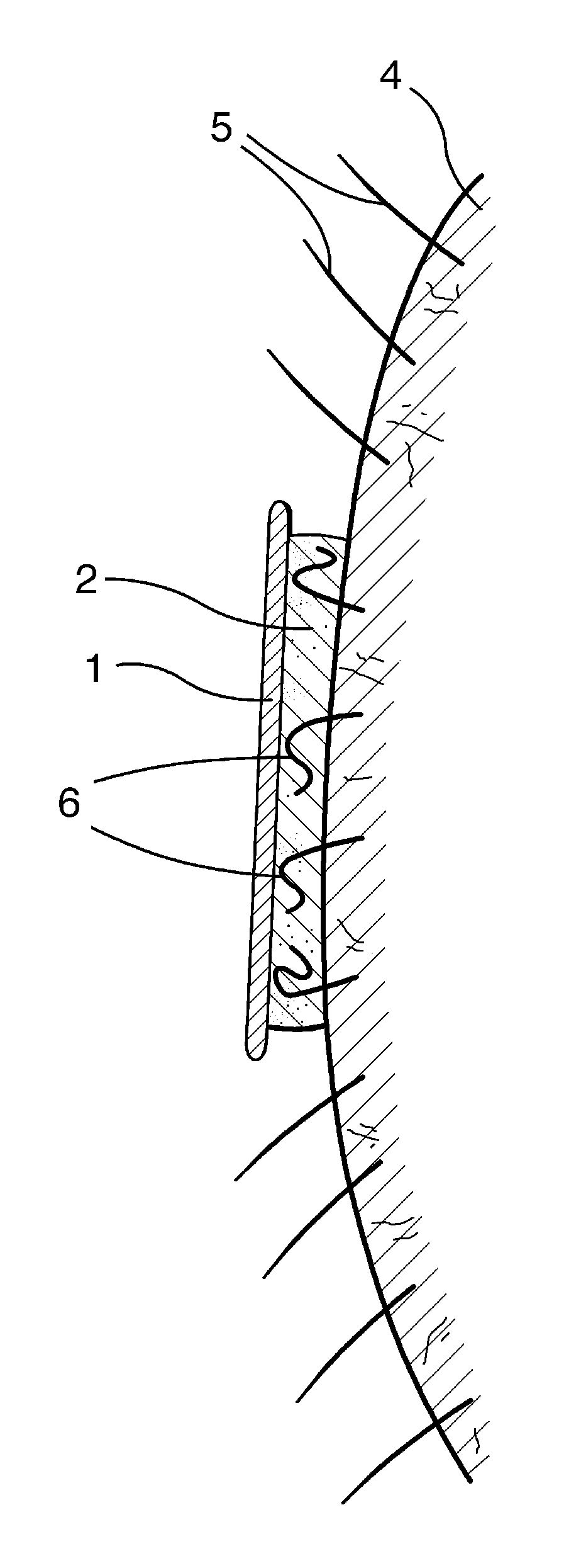 Substrate-Based Depilatory Article