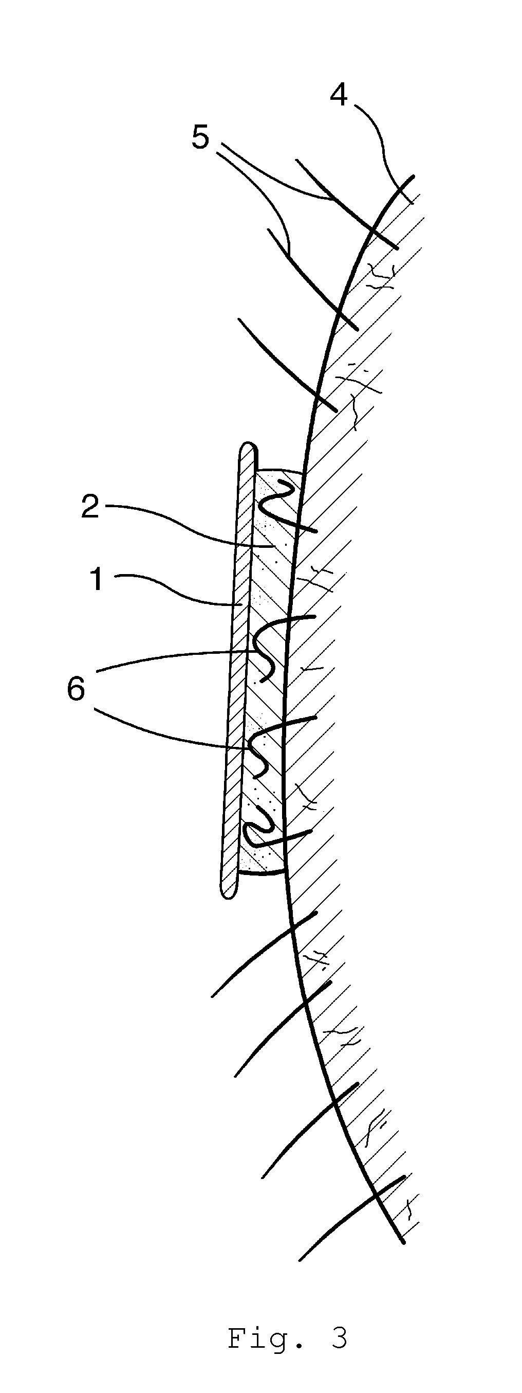 Substrate-Based Depilatory Article