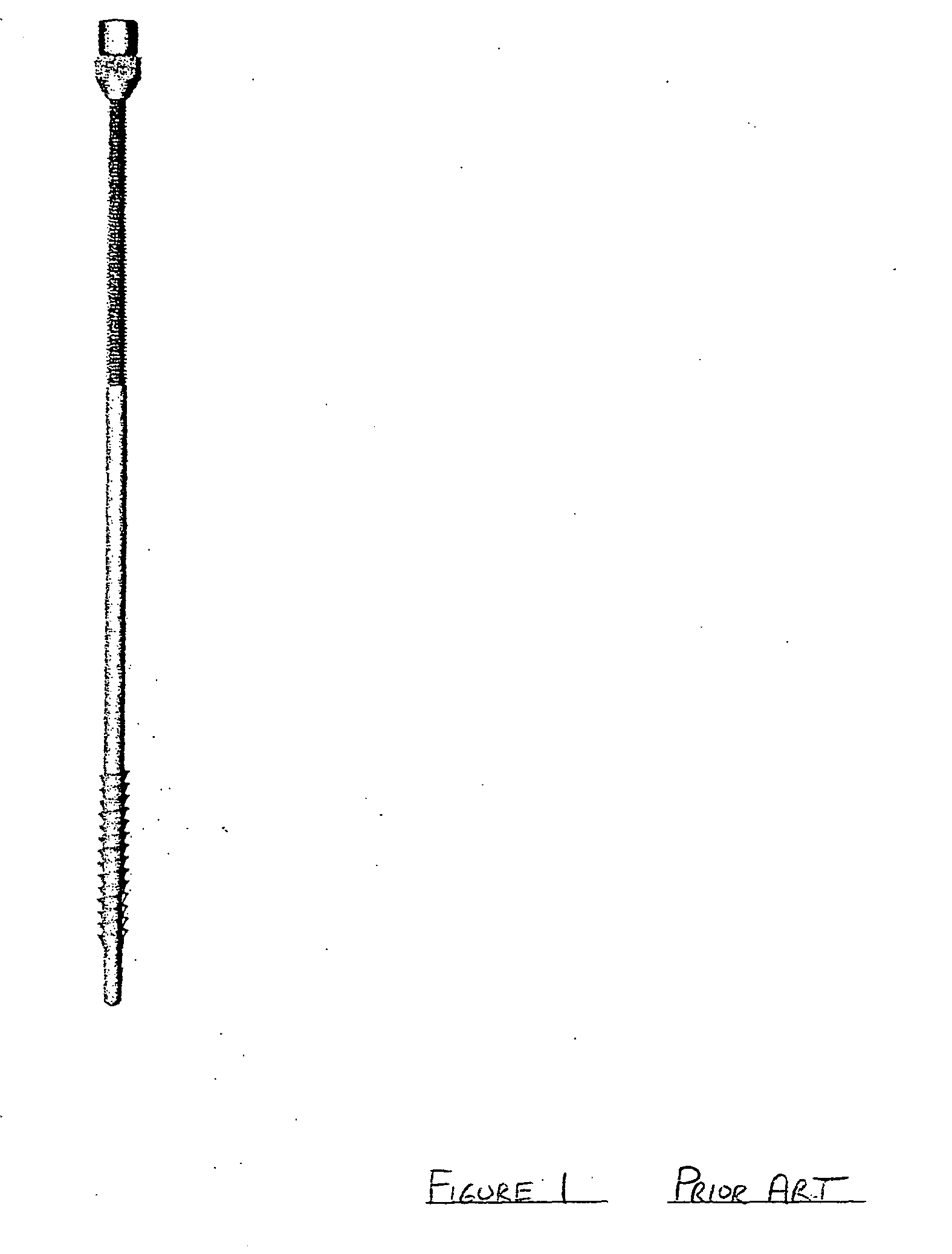 Clavicle repair device and orthopedic intramedullary fixation system