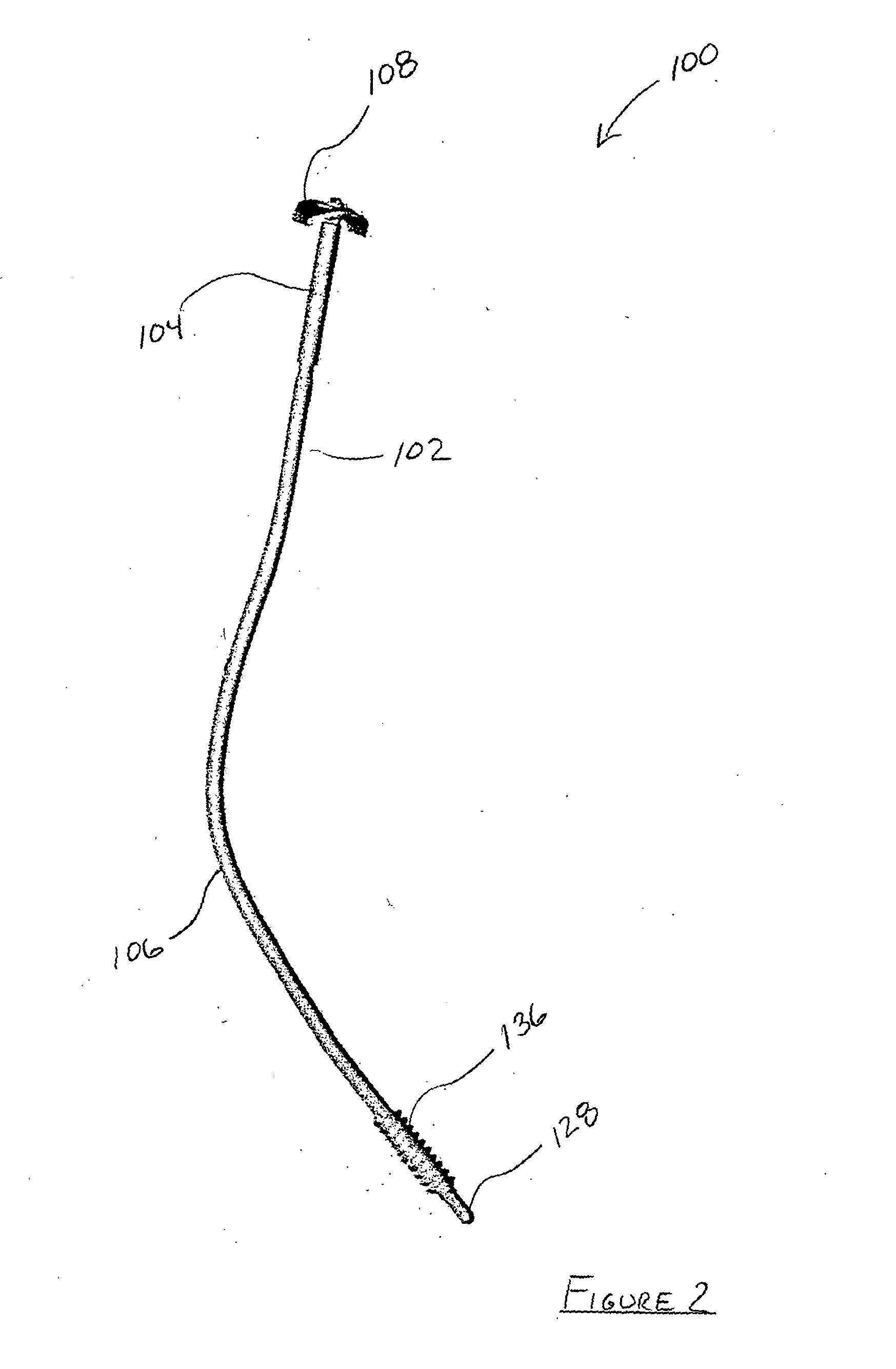 Clavicle repair device and orthopedic intramedullary fixation system