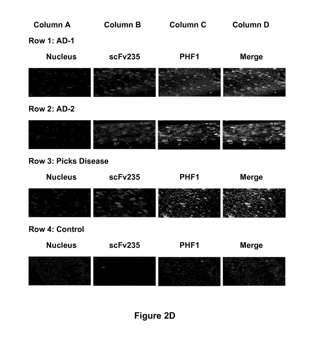 Tau imaging ligands and their uses in the diagnosis and treatment of tauopathy