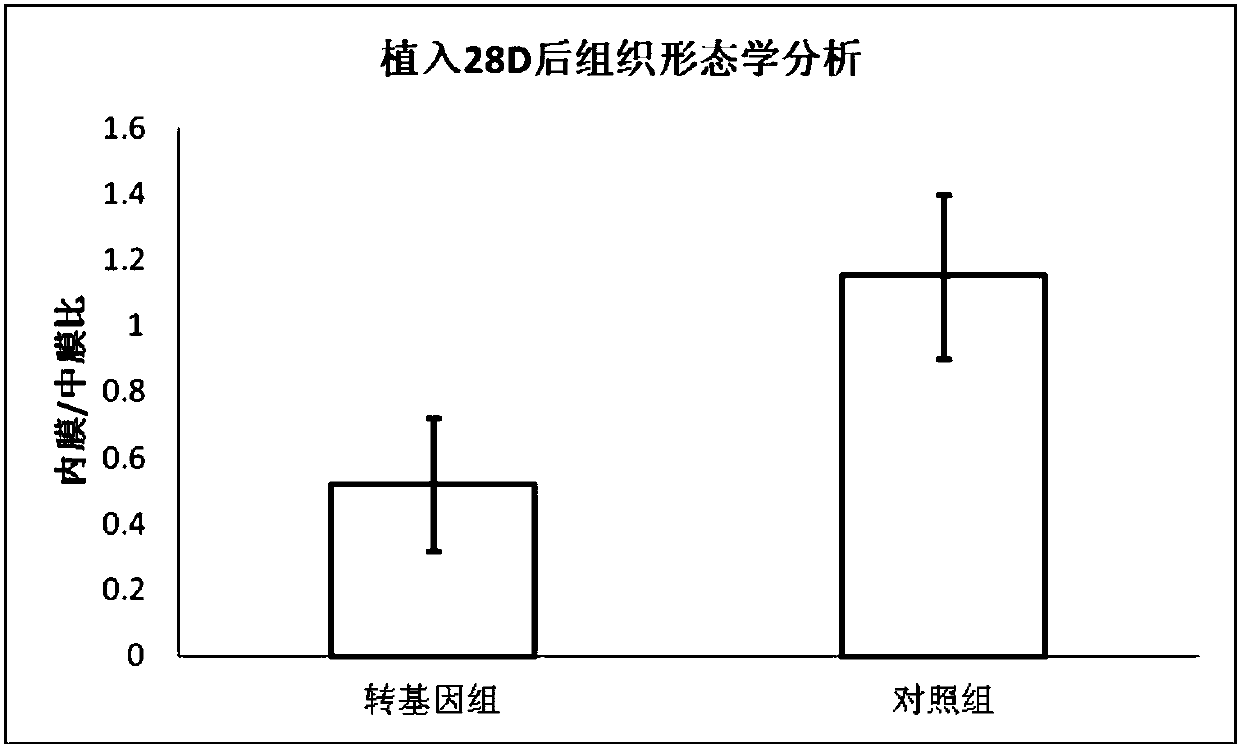 Drug-loaded balloon and preparation method thereof