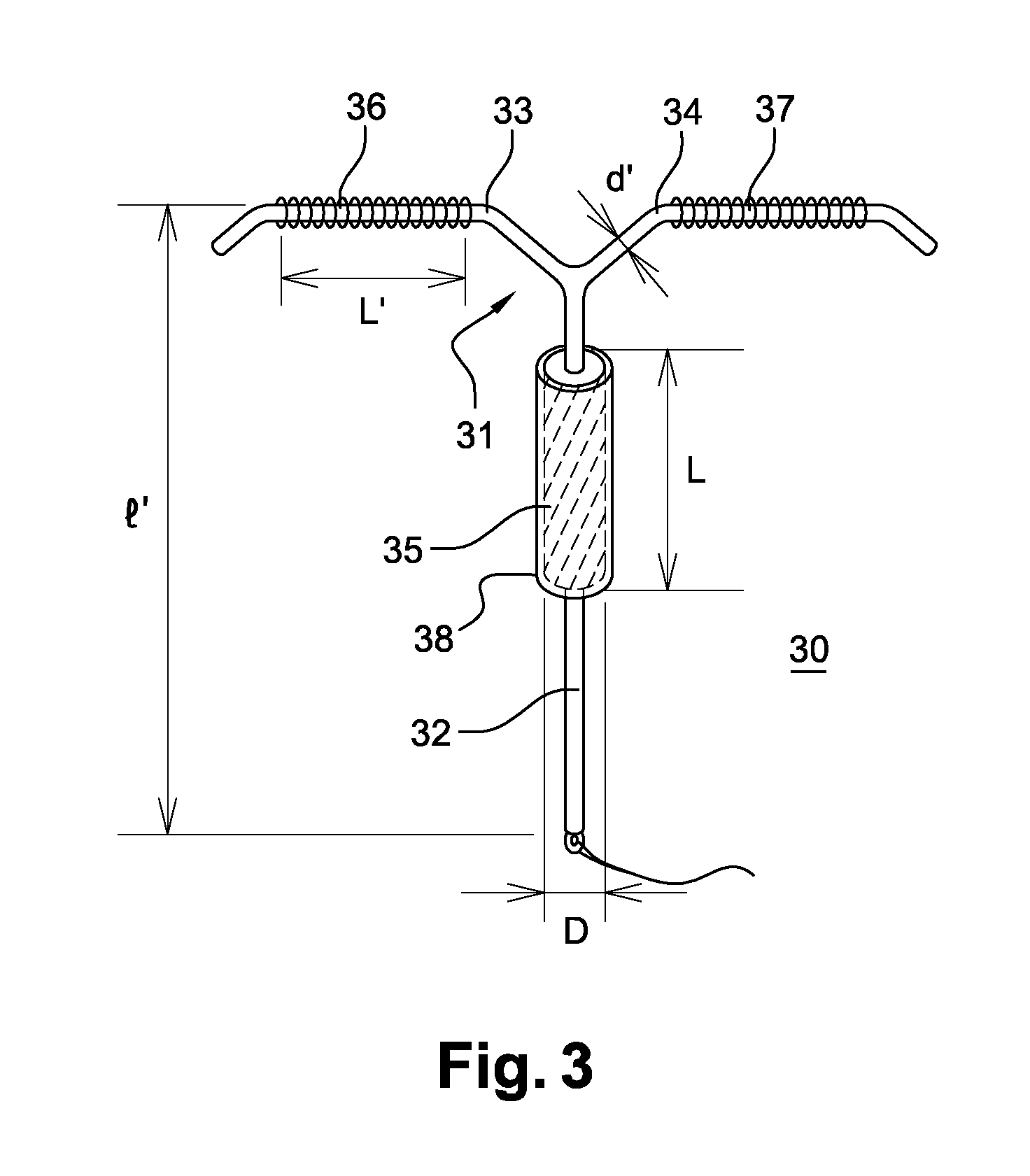 Copper intrauterine device