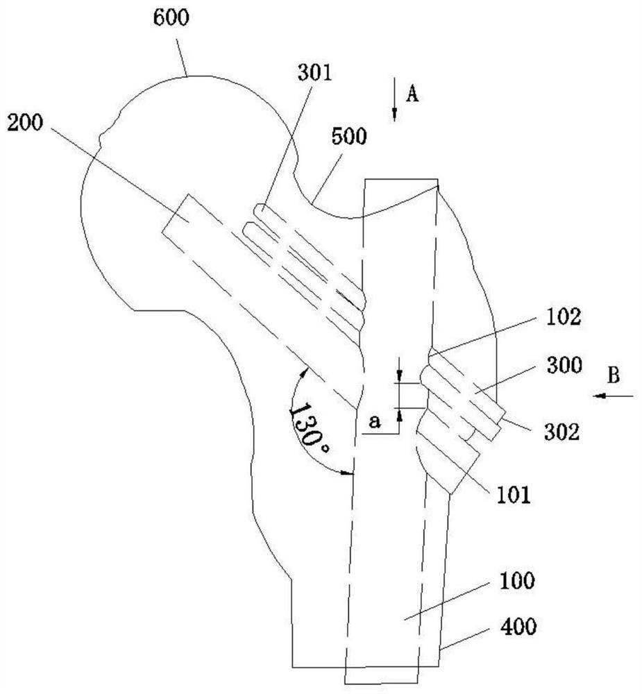 Novel head marrow nail capable of preventing head and neck bone blocks from tilting backward