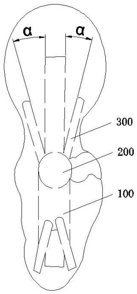 Novel head marrow nail capable of preventing head and neck bone blocks from tilting backward