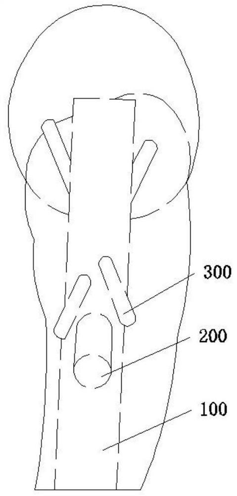 Novel head marrow nail capable of preventing head and neck bone blocks from tilting backward