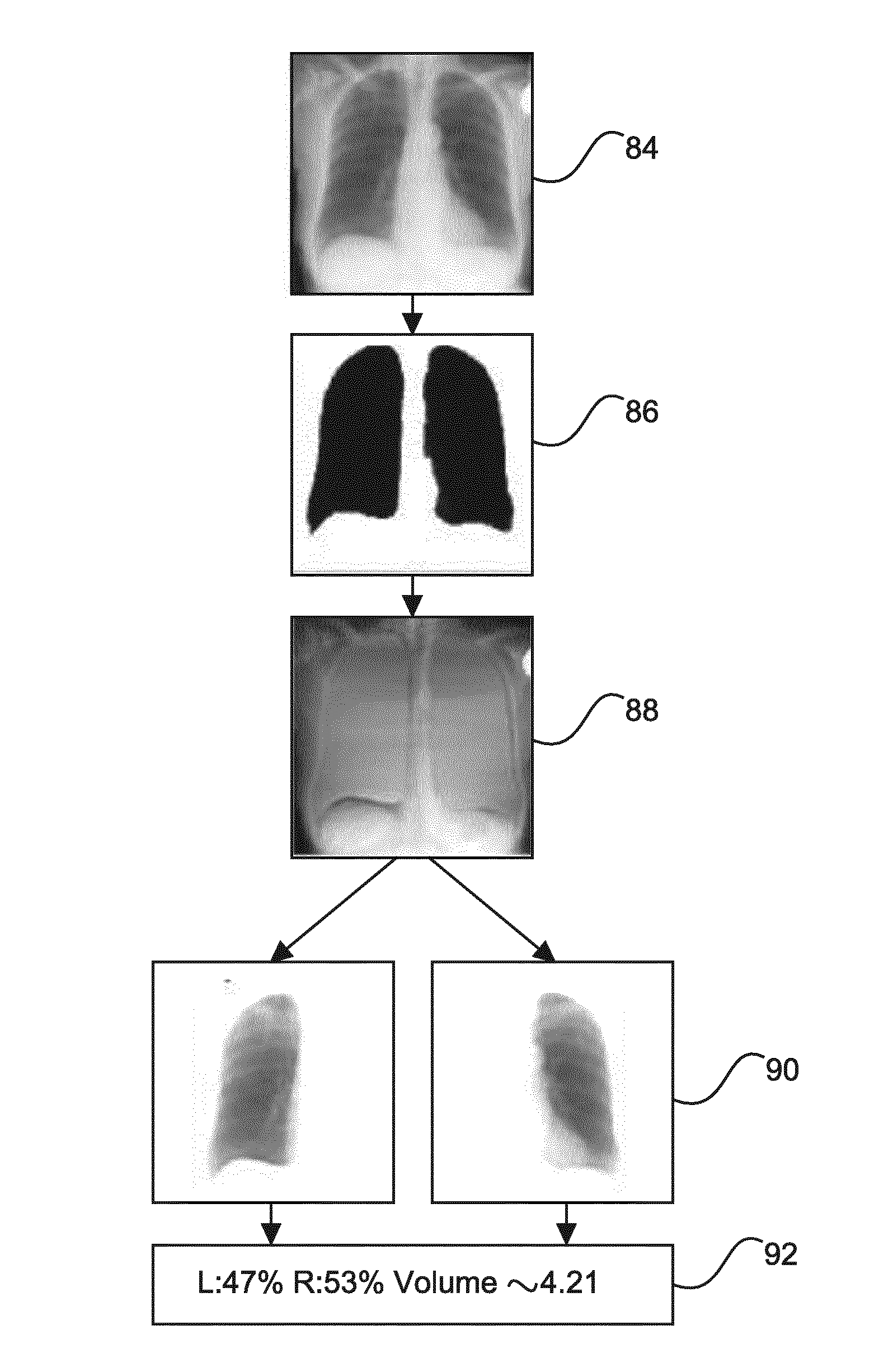 Lung measurements