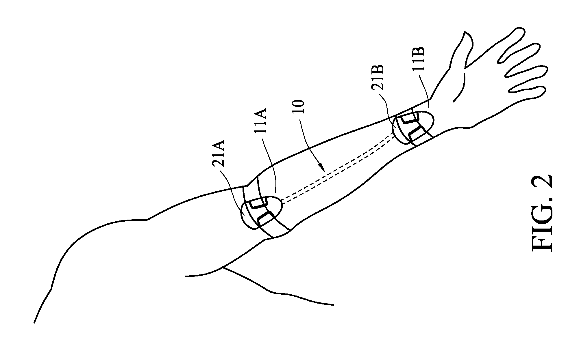 Non-invasive continuous blood pressure monitoring system and method