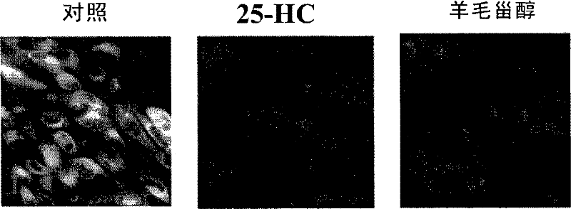 Cholesterol metabolism regulating and controlling medicament screening system and method with hydroxymethyl glutaryl cozymase A reductase as target point