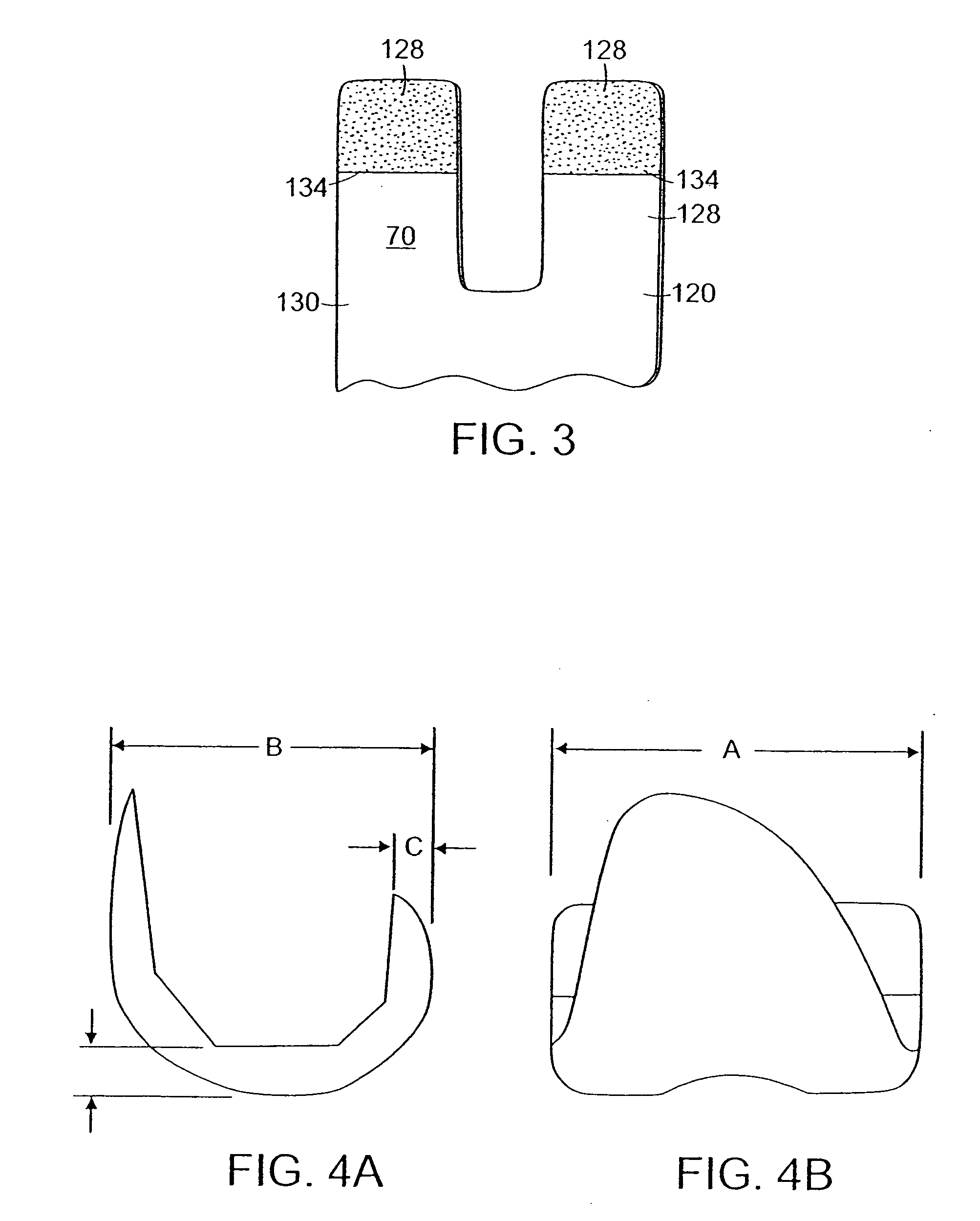 Knee prosthesis