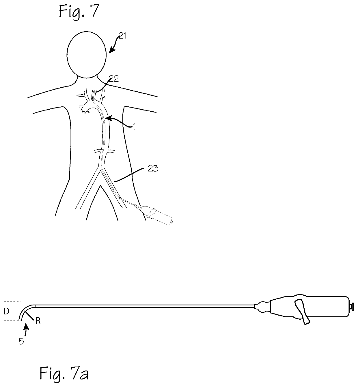 Devices and methods for accessing the vasculature of a patient