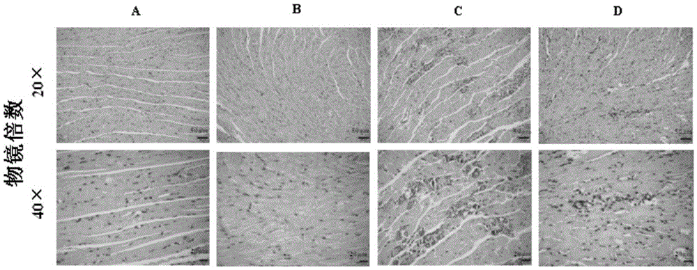 Application of berberine in preparing medicine for treating viral myocarditis caused by coxsackie virus b3