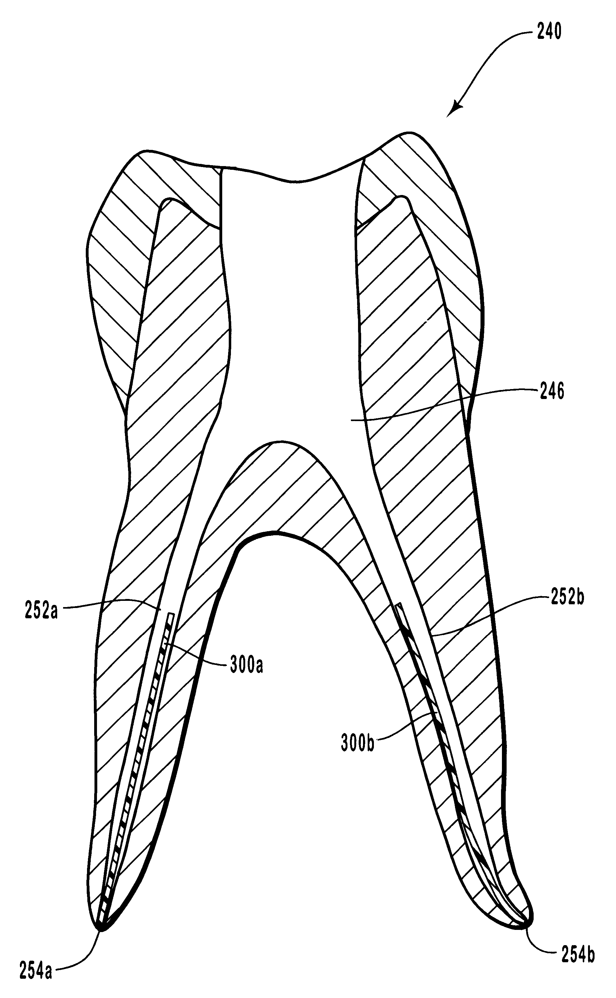 Endodontic systems and methods for preparing apical portions of root canals with a set of files having large tapers