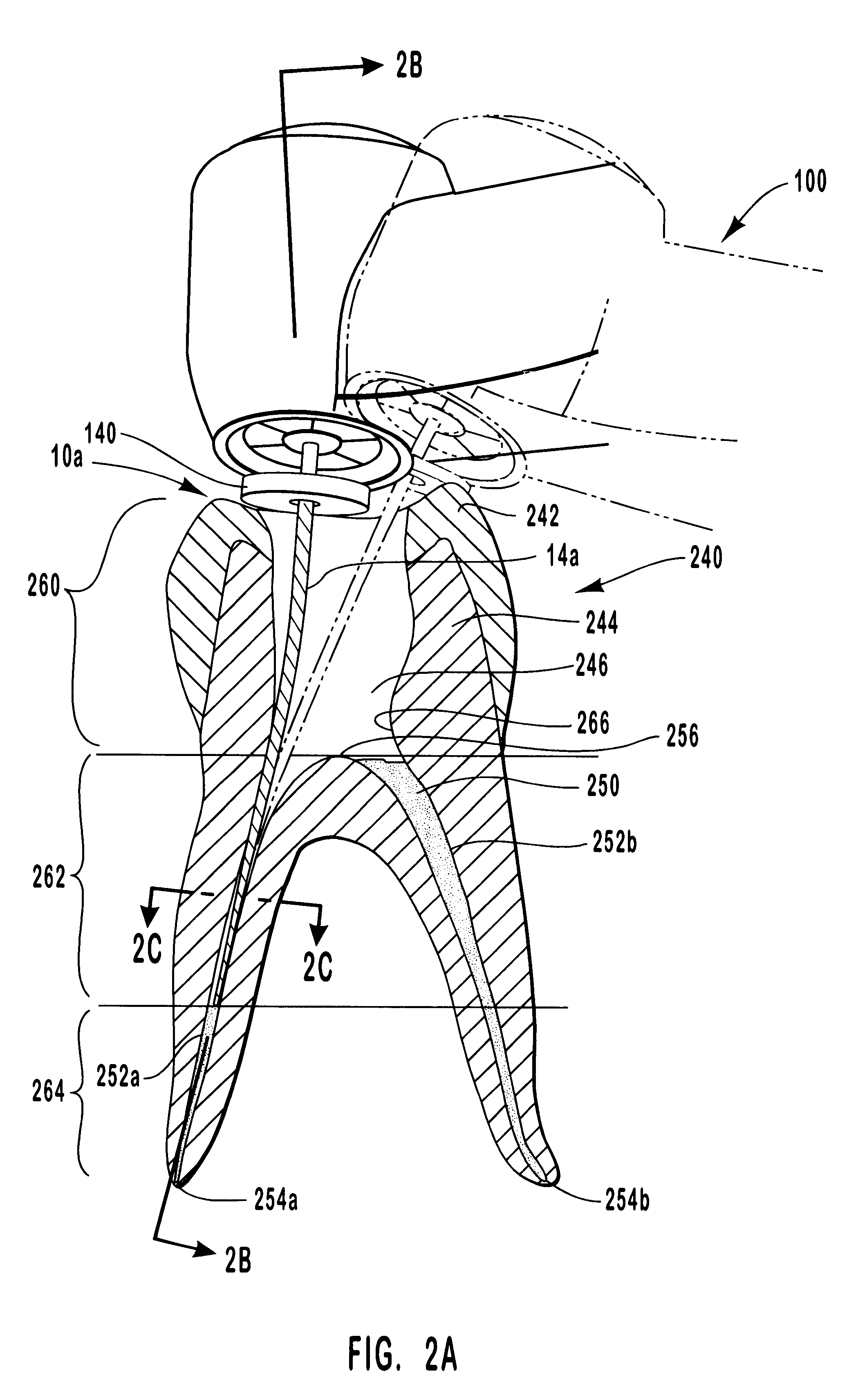 Endodontic systems and methods for preparing apical portions of root canals with a set of files having large tapers