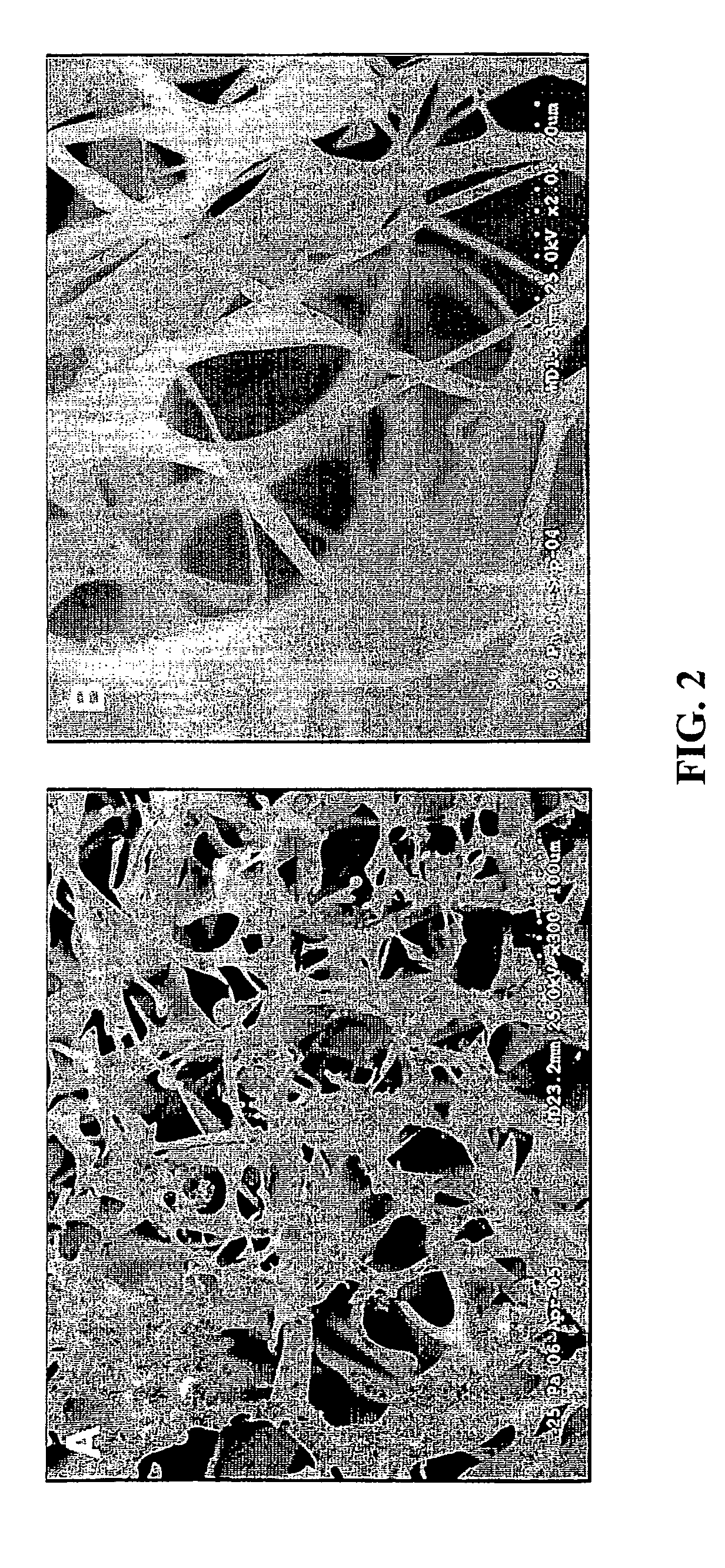 Nerve regeneration employing keratin biomaterials