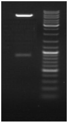 Preparation method of novel anti-human papilloma viral protein