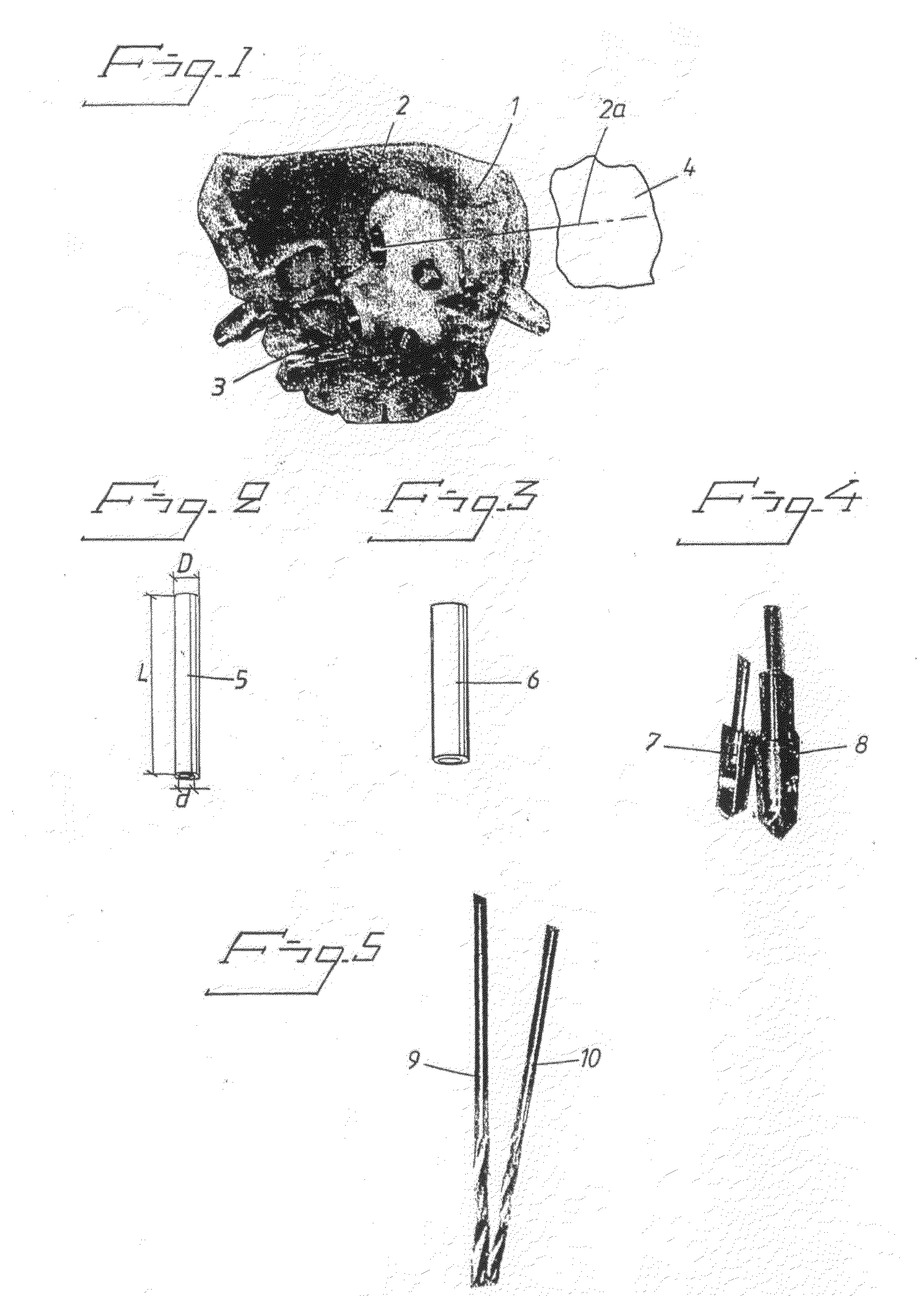 Drill template arrangement