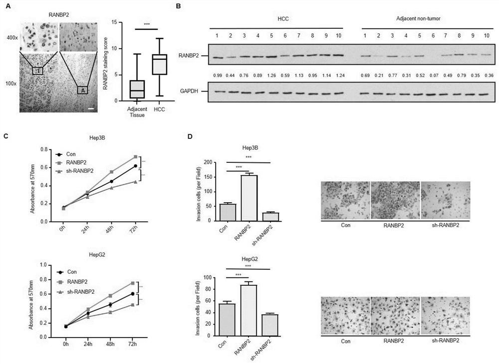 Application of CEBP alpha as RANBP2 target site in preparation of glycosylation medicine for treating liver cancer