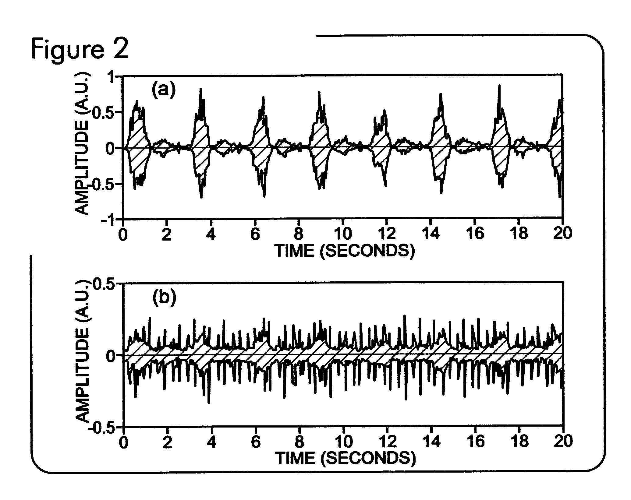 Respiratory signal detection and time domain signal processing method and system