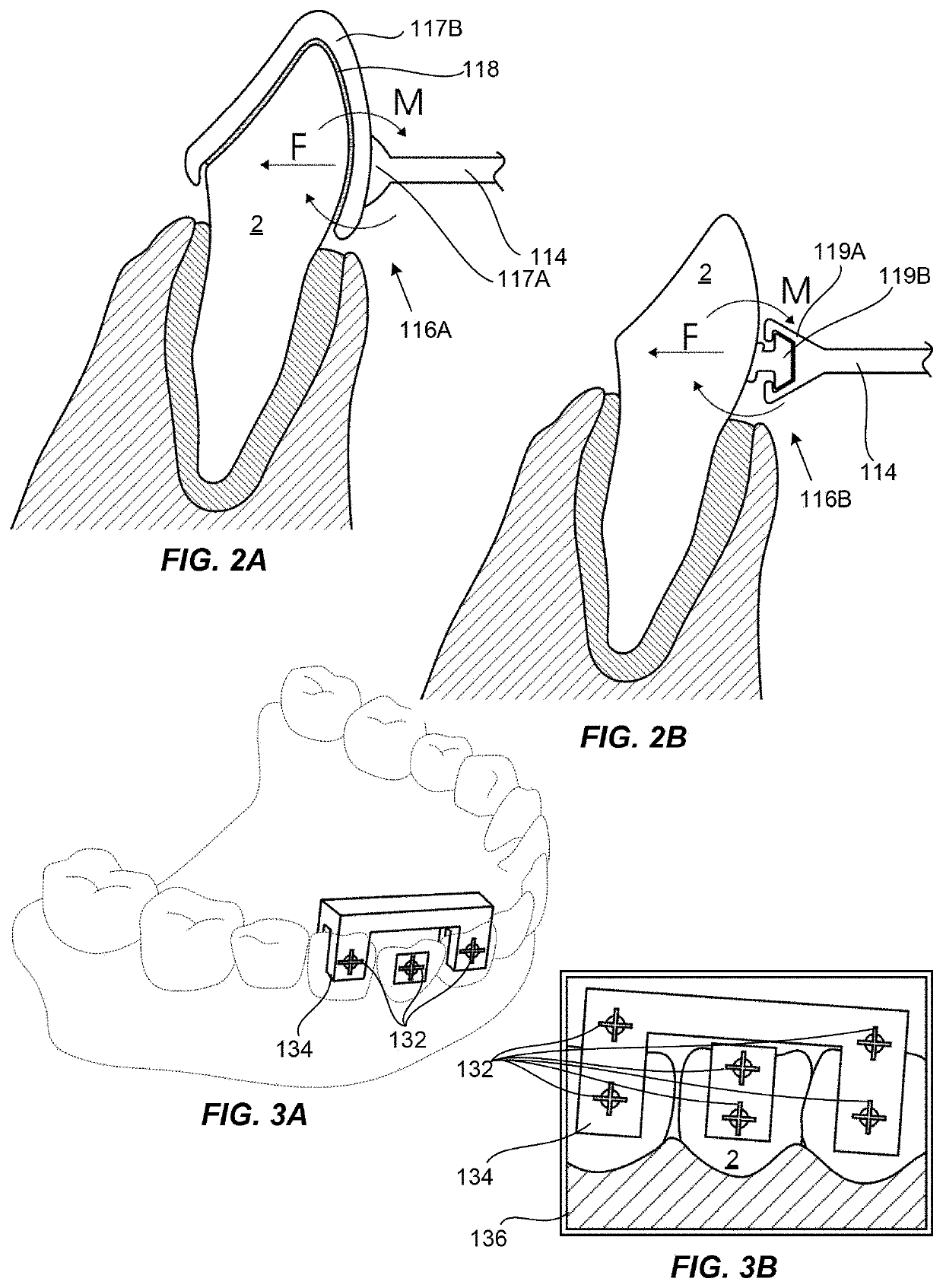 Method for providing orthodontic treatment