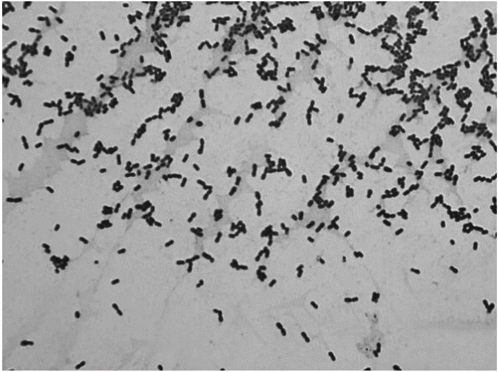 Lactobacillus reuteri and applications